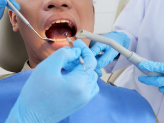 Endodonzia